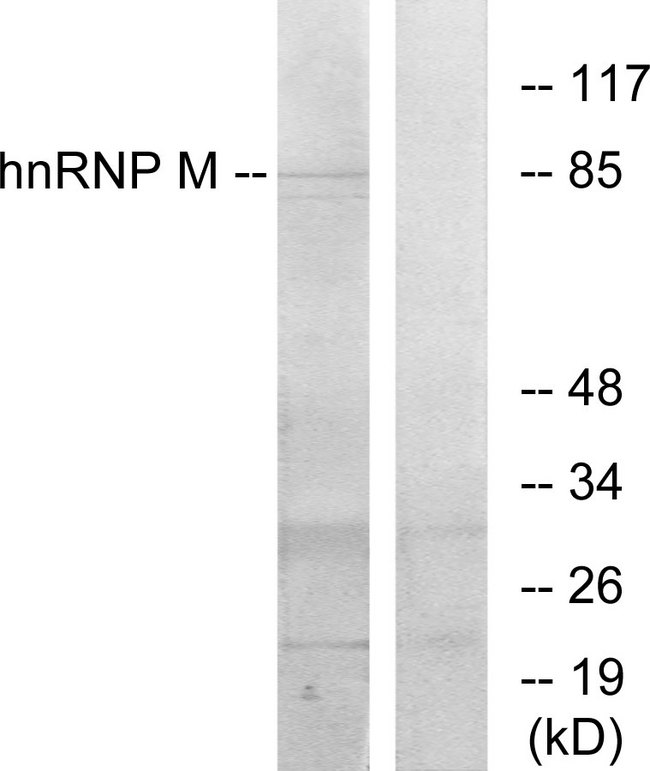 HNRPM / HNRNPM Antibody - Western blot analysis of lysates from HT-29 cells, using hnRNP M Antibody. The lane on the right is blocked with the synthesized peptide.