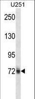 HNRPM / HNRNPM Antibody - HNRNPM Antibody western blot of U251 cell line lysates (35 ug/lane). The HNRNPM antibody detected the HNRNPM protein (arrow).