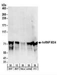 HNRPM / HNRNPM Antibody - Detection of Human and Mouse hnRNP M3/4 by Western Blot. Samples: Whole cell lysate from 293T (15 and 50 ug), HeLa (50 ug), Jurkat (50 ug), and mouse NIH3T3 (50 ug) cells. Antibodies: Affinity purified rabbit anti-hnRNP M3/4 antibody used for WB at 0.1 ug/ml. Detection: Chemiluminescence with an exposure time of 3 minutes.