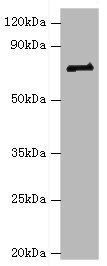 HNRPM / HNRNPM Antibody - Western blot All lanes: HNRNPM antibody at 2µg/ml + NIH/3T3 whole cell lysate Secondary Goat polyclonal to rabbit IgG at 1/10000 dilution Predicted band size: 78, 74 kDa Observed band size: 78 kDa