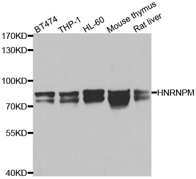HNRPM / HNRNPM Antibody - Western blot analysis of extracts of various cell lines.