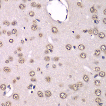 HNRPM / HNRNPM Antibody - Immunohistochemistry of paraffin-embedded rat brain tissue.