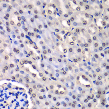 HNRPM / HNRNPM Antibody - Immunohistochemistry of paraffin-embedded mouse kidney tissue.