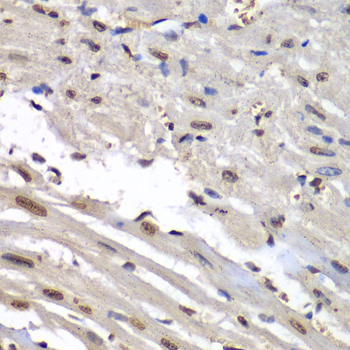 HNRPM / HNRNPM Antibody - Immunohistochemistry of paraffin-embedded mouse heart.