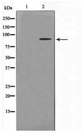 HNRPM / HNRNPM Antibody - Western blot of HT29 cell lysate using hnRNP M Antibody