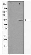 HNRPM / HNRNPM Antibody - Western blot of hnRNP M expression in HT29 cells