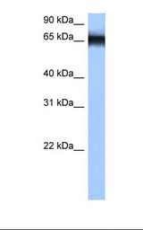 HNRPM / HNRNPM Antibody - Jurkat cell lysate. Antibody concentration: 0.5 ug/ml. Gel concentration: 12%.  This image was taken for the unconjugated form of this product. Other forms have not been tested.