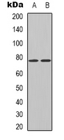 HNRPM / HNRNPM Antibody - Western blot analysis of hnRNP M expression in K562 (A); HepG2 (B) whole cell lysates.