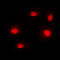 HNRPM / HNRNPM Antibody - Immunofluorescent analysis of hnRNP M staining in MCF7 cells. Formalin-fixed cells were permeabilized with 0.1% Triton X-100 in TBS for 5-10 minutes and blocked with 3% BSA-PBS for 30 minutes at room temperature. Cells were probed with the primary antibody in 3% BSA-PBS and incubated overnight at 4 deg C in a humidified chamber. Cells were washed with PBST and incubated with a DyLight 594-conjugated secondary antibody (red) in PBS at room temperature in the dark. DAPI was used to stain the cell nuclei (blue).