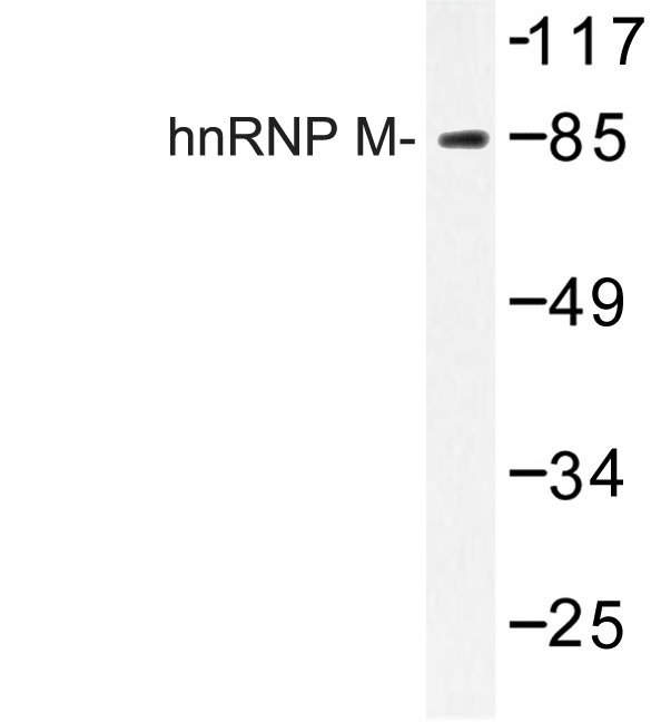 HNRPM / HNRNPM Antibody - Western blot of hn RNP M(P43) pAb in extracts from HT-29 cells.