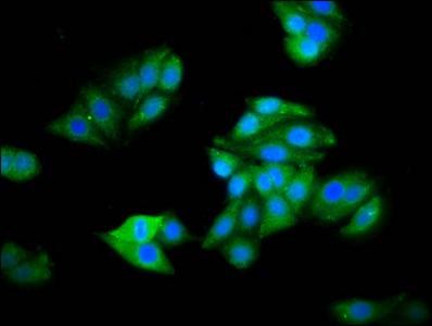 HOGA1 Antibody - Immunofluorescence staining of HepG2 cells diluted at 1:100, counter-stained with DAPI. The cells were fixed in 4% formaldehyde, permeabilized using 0.2% Triton X-100 and blocked in 10% normal Goat Serum. The cells were then incubated with the antibody overnight at 4°C.The Secondary antibody was Alexa Fluor 488-congugated AffiniPure Goat Anti-Rabbit IgG (H+L).