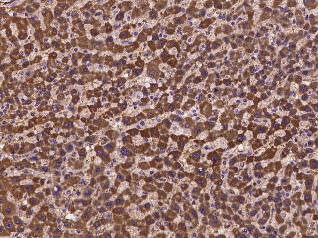 HOGA1 Antibody - Immunochemical staining of human HOGA1 in human liver with rabbit polyclonal antibody at 1:100 dilution, formalin-fixed paraffin embedded sections.
