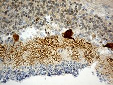 HOMER1 / Homer 1 Antibody - Immunohistochemical staining of paraffin-embedded Human embryonic cerebellum within the normal limits using anti-HOMER1 mouse monoclonal antibody. (Heat-induced epitope retrieval by 1mM EDTA in 10mM Tris buffer. (pH8.5) at 120 oC for 3 min. (1:500)