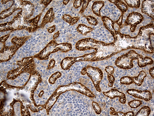 HOMER1 / Homer 1 Antibody - Immunohistochemical staining of paraffin-embedded Human spleen tissue within the normal limits using anti-HOMER1 mouse monoclonal antibody. (Heat-induced epitope retrieval by 1mM EDTA in 10mM Tris buffer. (pH8.5) at 120°C for 3 min. (1:500)