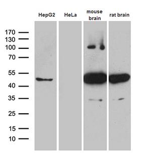HOMER1 / Homer 1 Antibody - Western blot analysis of extracts. (35ug) from 2 different cell lines and 2 different tissue lysates by using anti-HOMER1 monoclonal antibody. (1:500)