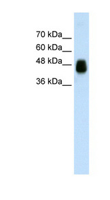 HOMER1 / Homer 1 Antibody - HOMER1 / Homer antibody Western blot of Transfected 293T cell lysate. This image was taken for the unconjugated form of this product. Other forms have not been tested.