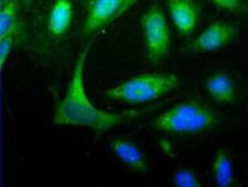 HOMER1 / Homer 1 Antibody - HOMER1 Antibody - Detection of HOMER1 (Green) in Hela cells. Nuclei (Blue) are counterstained using Hoechst 33258.