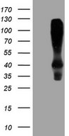 HOMER2 / Homer 2 Antibody - HEK293T cells were transfected with the pCMV6-ENTRY control. (Left lane) or pCMV6-ENTRY HOMER2. (Right lane) cDNA for 48 hrs and lysed. Equivalent amounts of cell lysates. (5 ug per lane) were separated by SDS-PAGE and immunoblotted with anti-HOMER2. (1:2000)