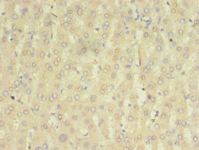 HOMER2 / Homer 2 Antibody - Immunohistochemistry of paraffin-embedded human liver tissue using HOMER2 Antibody at dilution of 1:100