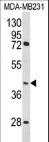 HOMER3 / Homer 3 Antibody - Western blot of HOMER3 Antibody in MDA-MB231 cell line lysates (35 ug/lane). HOMER3 (arrow) was detected using the purified antibody.