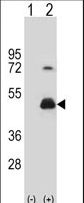 HOMER3 / Homer 3 Antibody - Western blot of HOMER3 (arrow) using rabbit polyclonal HOMER3 Antibody. 293 cell lysates (2 ug/lane) either nontransfected (Lane 1) or transiently transfected (Lane 2) with the HOMER3 gene.