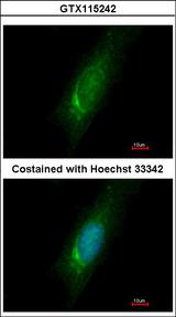 HOMER3 / Homer 3 Antibody - Immunofluorescence of methanol-fixed HeLa using Homer3 antibody at 1:500 dilution.