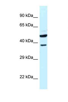 HOMER3 / Homer 3 Antibody - HOMER3 antibody western blot of Human fetal liver lysate. Antibody concentration 1 ug/ml.  This image was taken for the unconjugated form of this product. Other forms have not been tested.