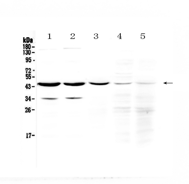 HOMER3 / Homer 3 Antibody - Western blot analysis of HOMER3 using anti-HOMER3 antibody. Electrophoresis was performed on a 5-20% SDS-PAGE gel at 70V (Stacking gel) / 90V (Resolving gel) for 2-3 hours. The sample well of each lane was loaded with 50ug of sample under reducing conditions. Lane 1: rat brain tissue lysate,Lane 2: mouse brain tissue lysate,Lane 3: human U-87MG whole Cell lysate,Lane 4: human Hela whole Cell lysate,Lane 5: human Jurkat whole Cell lysate. After Electrophoresis, proteins were transferred to a Nitrocellulose membrane at 150mA for 50-90 minutes. Blocked the membrane with 5% Non-fat Milk/ TBS for 1.5 hour at RT. The membrane was incubated with rabbit anti-HOMER3 antigen affinity purified polyclonal antibody at 0.5 µg/mL overnight at 4°C, then washed with TBS-0.1% Tween 3 times with 5 minutes each and probed with a goat anti-rabbit IgG-HRP secondary antibody at a dilution of 1:10000 for 1.5 hour at RT. The signal is developed using an Enhanced Chemiluminescent detection (ECL) kit with Tanon 5200 system. A specific band was detected for HOMER3 at approximately 45KD. The expected band size for HOMER3 is at 40KD.
