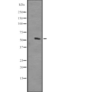 HOMEZ Antibody - Western blot analysis of HOMEZ expression in human placenta lysate. The lane on the left is treated with the antigen-specific peptide.