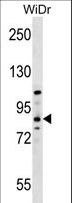 HOOK1 Antibody - HOOK1 Antibody western blot of WiDr cell line lysates (35 ug/lane). The HOOK1 antibody detected the HOOK1 protein (arrow).