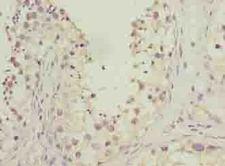 HOOK1 Antibody - Immunohistochemistry of paraffin-embedded human testis tissue using antibody at dilution of 1:100.