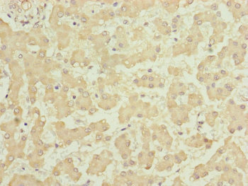 HOOK2 Antibody - Immunohistochemistry of paraffin-embedded human liver tissue at dilution of 1:100