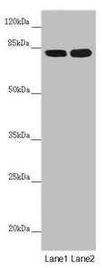 HOOK2 Antibody - Western blot All Lanes:HOOK2 antibody at 4.11 ug/ml Lane 1: Mouse small intestine tissue Lane 2: A431 whole cell lysate Secondary Goat polyclonal to rabbit IgG at 1/10000 dilution Predicted band size: 83 kDa Observed band size: 83 kDa