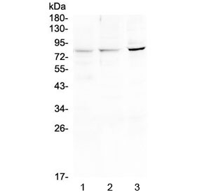 HOOK2 Antibody - Western blot testing of 1) rat liver, 2) mouse liver and 3) A549 lysate with HOOK2 antibody at 0.5ug/ml. Predicted molecular weight ~83 kDa.