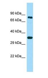 HOOK3 Antibody - HOOK3 antibody Western Blot of Fetal Kidney.  This image was taken for the unconjugated form of this product. Other forms have not been tested.