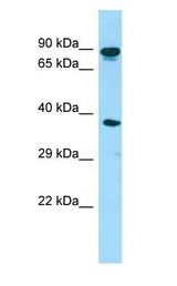 HOOK3 Antibody - HOOK3 antibody Western Blot of Fetal Heart.  This image was taken for the unconjugated form of this product. Other forms have not been tested.