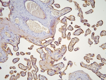 HOOK3 Antibody - IHC staining of FFPE human placenta with HOOK3 antibody at 1ug/ml. HIER: boil tissue sections in pH6, 10mM citrate buffer, for 10-20 min and allow to cool before testing.