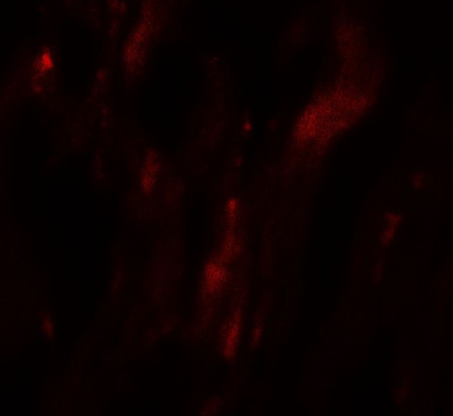 HOPX / HOP Antibody - Immunofluorescence of HOPX in human heart tissue with HOPX antibody at 20 ug/mL.