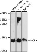 HOPX / HOP Antibody - Western blot analysis of extracts of various cell lines, using HOPX antibody at 1:1000 dilution. The secondary antibody used was an HRP Goat Anti-Rabbit IgG (H+L) at 1:10000 dilution. Lysates were loaded 25ug per lane and 3% nonfat dry milk in TBST was used for blocking. An ECL Kit was used for detection and the exposure time was 90s.