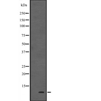 HOPX / HOP Antibody - Western blot analysis of HOP expression in human fetal heart tissue lysate. The lane on the left is treated with the antigen-specific peptide.