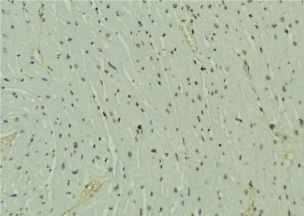 HOPX / HOP Antibody - 1:100 staining mouse muscle tissue by IHC-P. The sample was formaldehyde fixed and a heat mediated antigen retrieval step in citrate buffer was performed. The sample was then blocked and incubated with the antibody for 1.5 hours at 22°C. An HRP conjugated goat anti-rabbit antibody was used as the secondary.