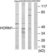 HORMAD1 Antibody - Western blot analysis of lysates from HeLa, HUVEC, and COLO cells, using HORMAD1 Antibody. The lane on the right is blocked with the synthesized peptide.