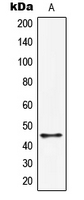 HORMAD1 Antibody - Western blot analysis of HORMAD1 expression in HepG2 (A) whole cell lysates.