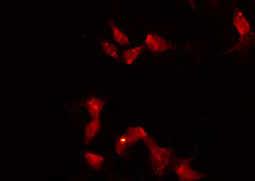 HORMAD1 Antibody - Staining HeLa cells by IF/ICC. The samples were fixed with PFA and permeabilized in 0.1% Triton X-100, then blocked in 10% serum for 45 min at 25°C. The primary antibody was diluted at 1:200 and incubated with the sample for 1 hour at 37°C. An Alexa Fluor 594 conjugated goat anti-rabbit IgG (H+L) Ab, diluted at 1/600, was used as the secondary antibody.
