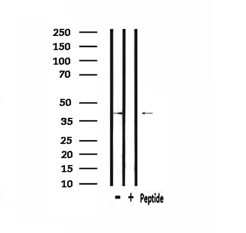 HORMAD1 Antibody - Western blot analysis of extracts of mouse muscle using HORMAD1 antibody.