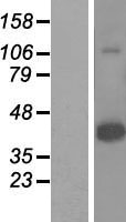 HORMAD1 Protein - Western validation with an anti-DDK antibody * L: Control HEK293 lysate R: Over-expression lysate
