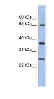 HORMAD2 Antibody - HORMAD2 antibody Western blot of Placenta lysate. This image was taken for the unconjugated form of this product. Other forms have not been tested.