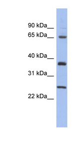 HORMAD2 Antibody - HORMAD2 antibody Western blot of Placenta lysate. This image was taken for the unconjugated form of this product. Other forms have not been tested.