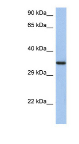 HORMAD2 Antibody - HORMAD2 antibody Western blot of HT1080 cell lysate. This image was taken for the unconjugated form of this product. Other forms have not been tested.