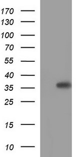 HORMAD2 Antibody - HEK293T cells were transfected with the pCMV6-ENTRY control (Left lane) or pCMV6-ENTRY HORMAD2 (Right lane) cDNA for 48 hrs and lysed. Equivalent amounts of cell lysates (5 ug per lane) were separated by SDS-PAGE and immunoblotted with anti-HORMAD2.